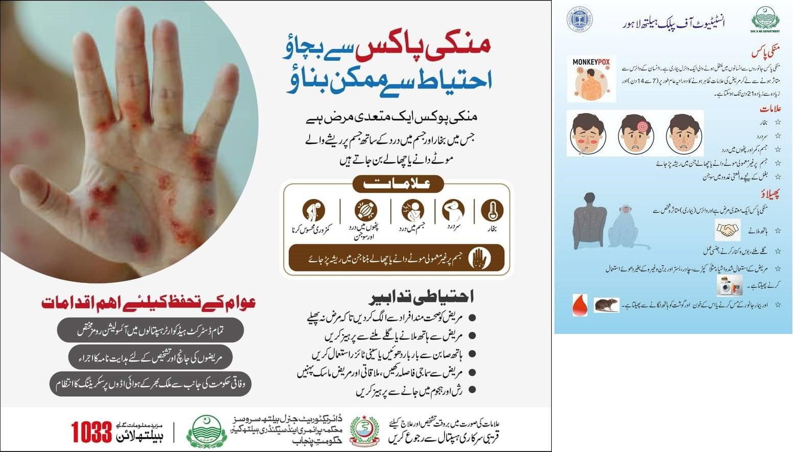 منکی پاکس،علامات،احتیاطی تدابیر اور محکمہ صحت گلگت بلتستان کے اقدامات۔